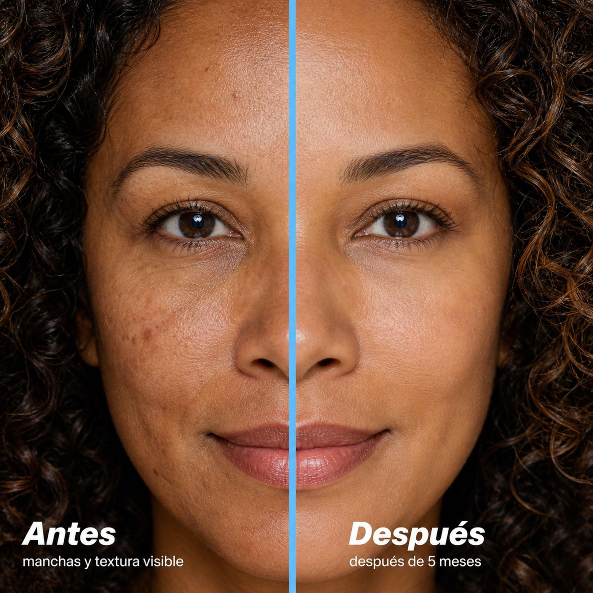 Antes y después de 5 meses: piel con menos manchas y textura más uniforme