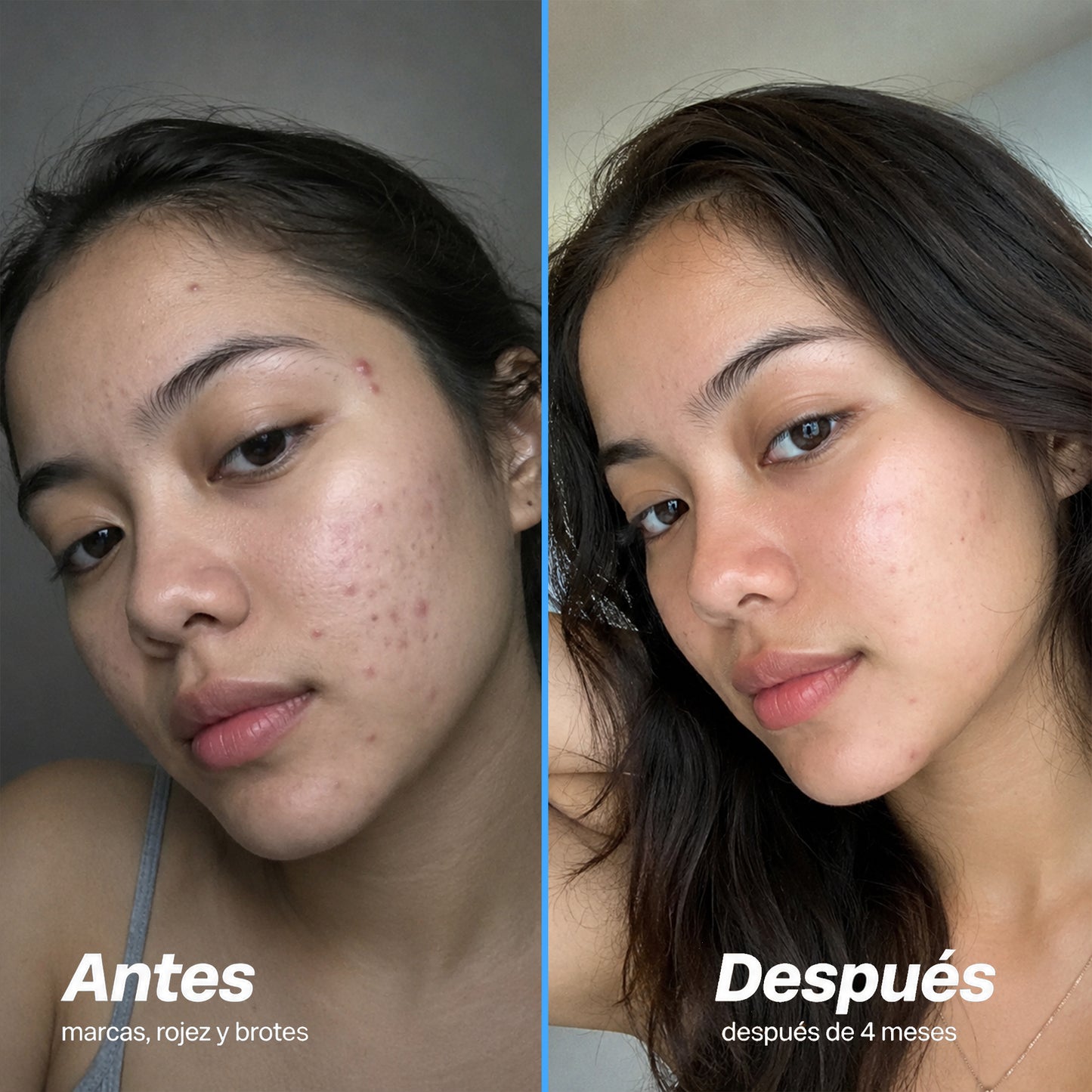 Serum Personalizado Rx