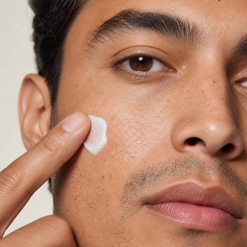 Aplicando humectante personalizado en la mejilla para piel sensible y manchas post-acné